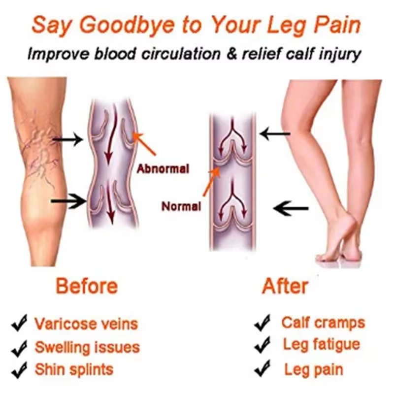 Calze a Compressione per Donne - Echinacea recensione e prezzo